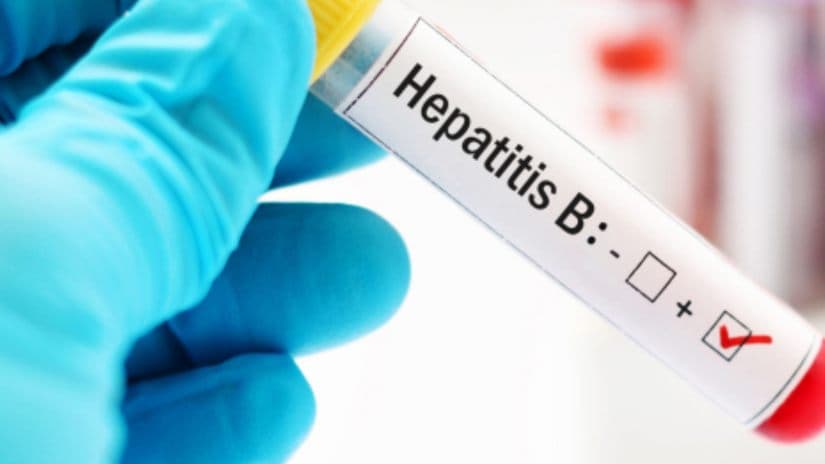 Georgia launches state hepatitis B management program
