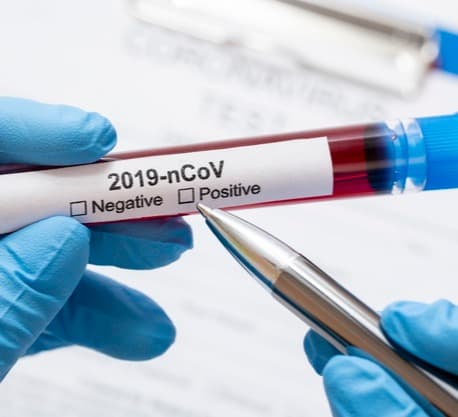 კორონავირუსის 723 ახალი შემთხვევიდან 321 თბილისში გამოვლინდა