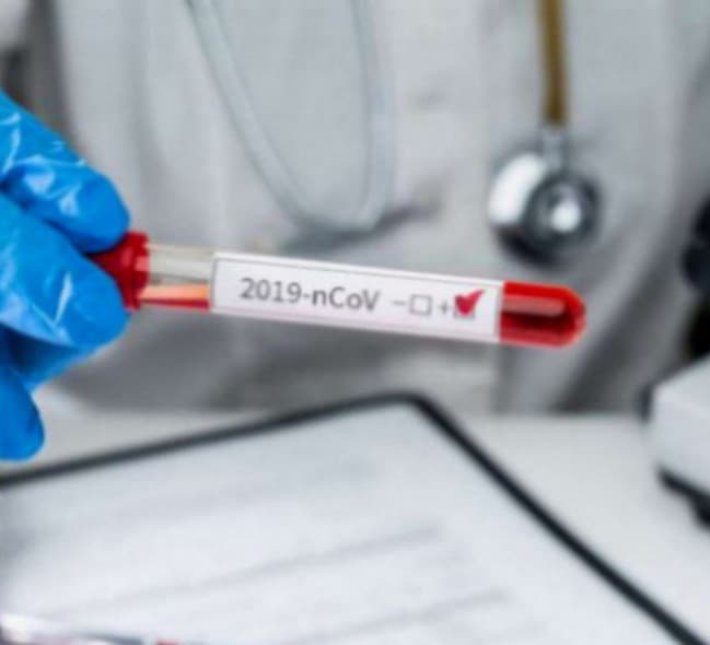 კორონავირუსის  676 ახალი შემთხვევიდან 253 თბილისში გამოვლინდა