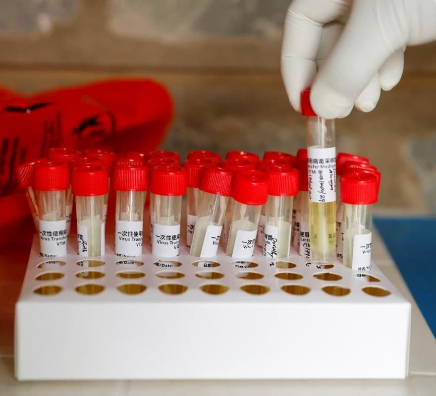 During the day, 165 people died in Ukraine due to COVID-19, 3,285 new cases were detected, 10,101 people recovered