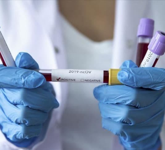 კორონავირუსის 602 ახალი შემთხვევიდან 246 თბილისში გამოვლინდა, 101 – იმერეთში