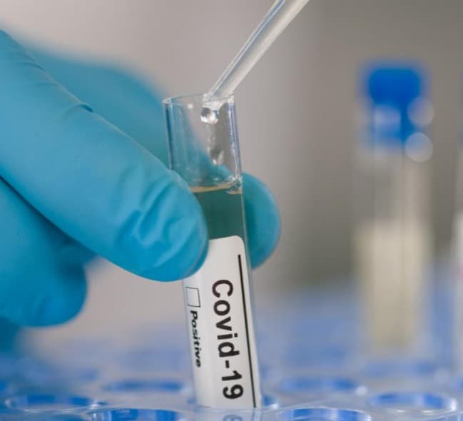 საქართველოში კორონავირუსის 396 ახალი შემთხვევა გამოვლინდა, 469 ადამიანი გამოჯანმრთელდა