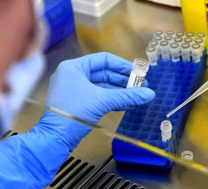 საქართველოში 24 საათში კორონავირუსით 10 ადამიანი გარდაიცვალა