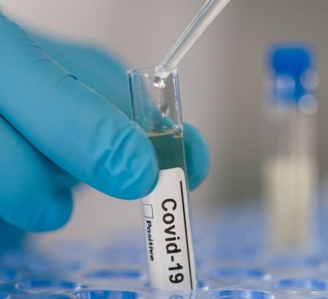 Out of 373 new cases of coronavirus, 177 were detected in Tbilisi