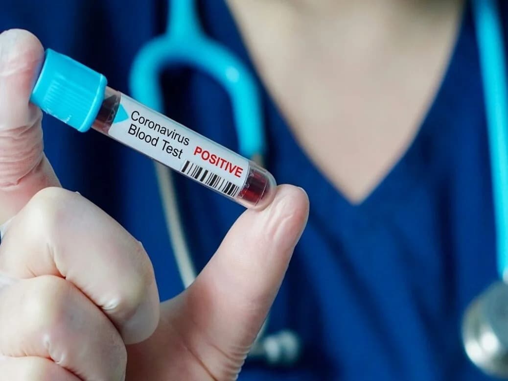 Covid peak expected in Autumn, daily cases surge – Tbilisi Infectious Diseases Centre