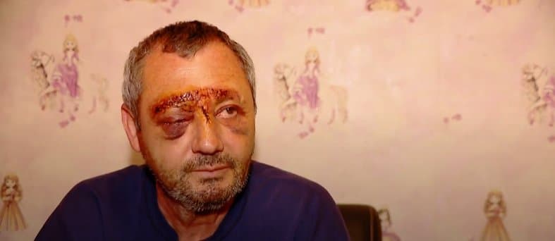 ზაზა ბირიაშვილი – ვერ ვხედავ მარჯვენა თვალიდან, არაფერი აღარ ჩანს