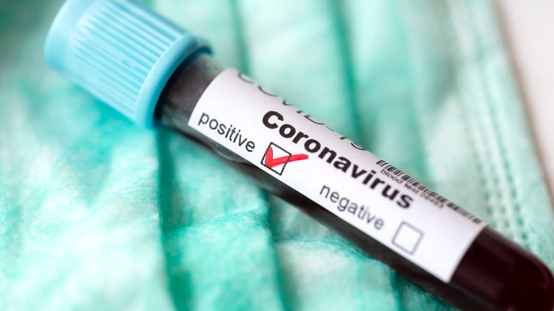 Coronavirus cases on upward trend in Georgia