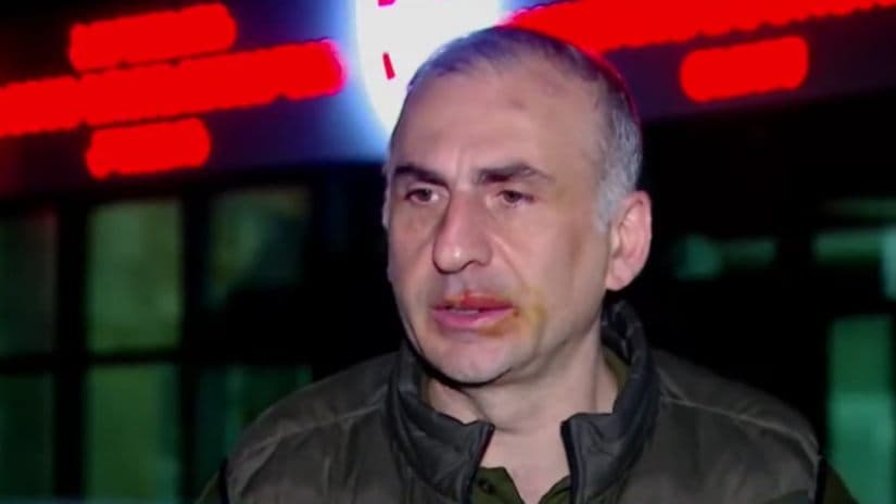 Opposition leader alleges assault by law enforcement