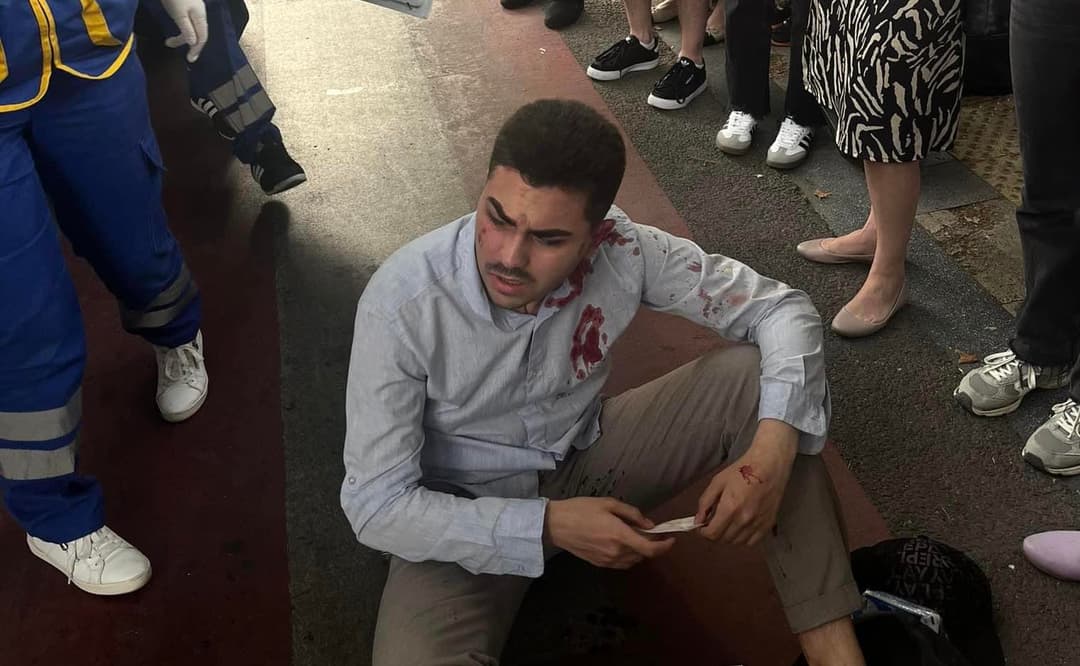 სტუდენტ ნიკო მანაგაძეს თავს დაესხნენ