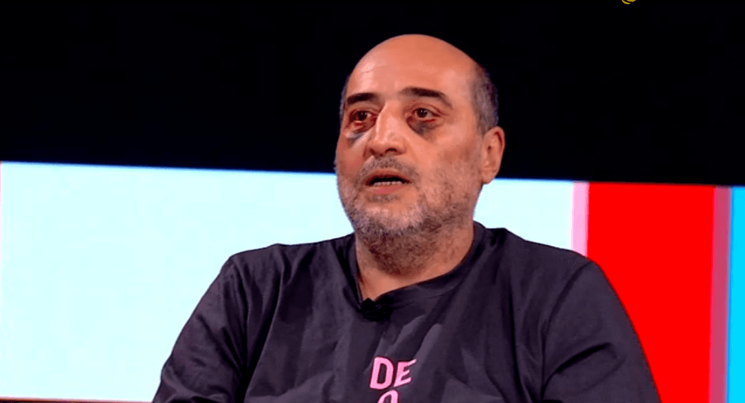 Special Investigation Service to look into attack on journalist, not Interior Ministry