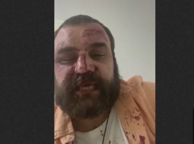 დიმიტრი ჩიქოვანს ფიზიკურად გაუსწორდნენ