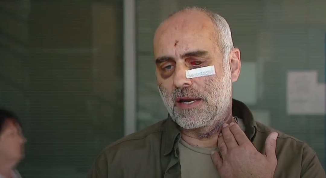 დავით ქაცარავა – ჩანს კვალი, როგორ მახრჩობდნენ ე.წ. სპეცრაზმელები, იყო მცდელობა ჩემი გაგუდვის