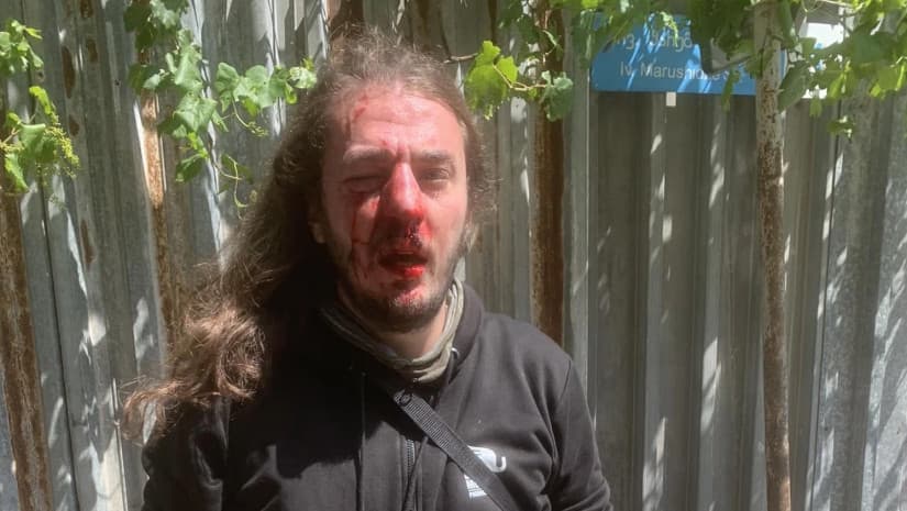 Civic activist Zuka Berdzenishvili assaulted after accusations voiced by Parliamnet Speaker