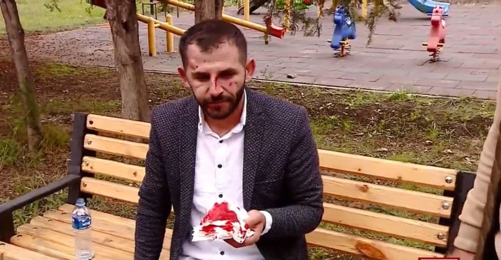 One injured after physical confrontation at polling station in Marneuli