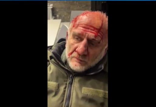 კობა ხაბაზს თავს დაესხნენ და ფიზიკურად გაუსწორდნენ