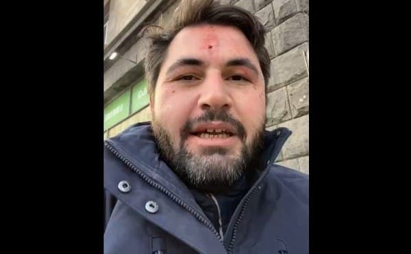 თავდასხმის შემდეგ ლაშა გაბიტაშვილს ტვინის შერყევა აქვს, გამოძიება ჯგუფური ძალადობის მუხლით დაიწყო