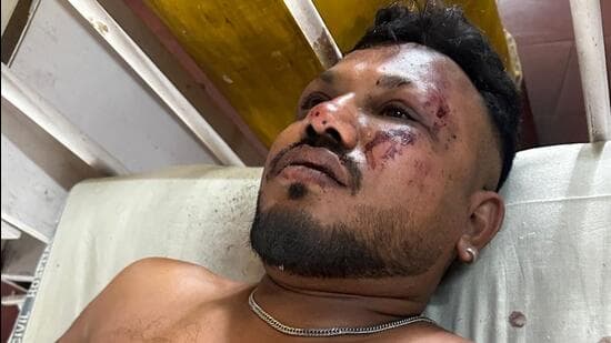 One passenger survives plane crash in India carrying 242