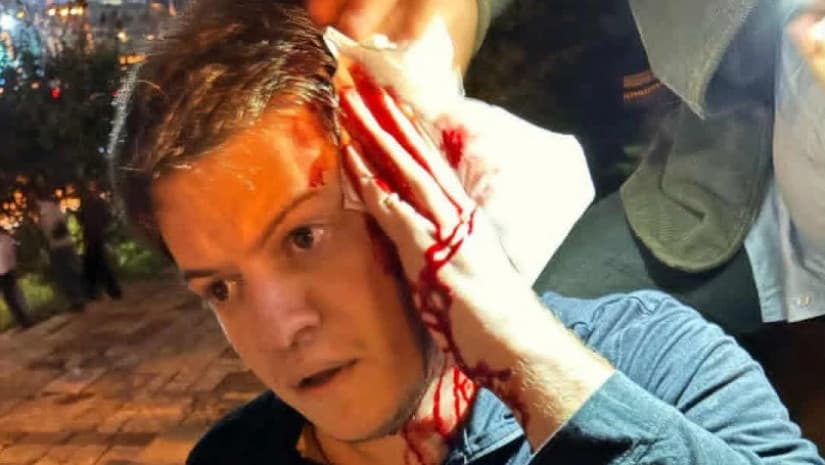 Frontnews image description